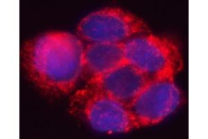 IF analysis of HSD17B7 using anti-HSD17B7 antibody (ABIN7600174). (HSD17B7 Antikörper  (AA 16-336))