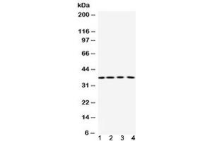 Western blot testing of 1) rat thymus, 2) rat ovary, 3) mouse liver and 4) human placenta lysate using Purine nucleoside phosphorylase antibody at 0. (PNP Antikörper  (AA 161-189))
