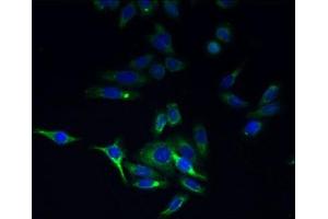 Immunofluorescent analysis of HepG2 cells using ABIN7173221 at dilution of 1:100 and Alexa Fluor 488-congugated AffiniPure Goat Anti-Rabbit IgG(H+L) (TMEM44 Antikörper  (AA 269-439))