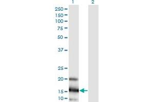 Western Blot analysis of LOC402176 expression in transfected 293T cell line by LOC402176 monoclonal antibody (M03), clone 3E7.