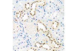 Immunohistochemistry of paraffin-embedded rat kidney using THOC1 antibody (ABIN5974800) at dilution of 1/100 (40x lens). (THOC1 Antikörper)