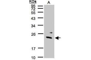 WB Image Sample(30 μg of whole cell lysate) A:293T 12% SDS PAGE antibody diluted at 1:1000 (GUK1 Antikörper)
