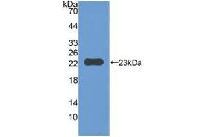 Western blot analysis of recombinant Mouse IAP. (CD47 Antikörper  (AA 18-219))