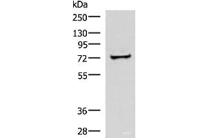 Western blot analysis of Human liver tissue lysate using ZNF263 Polyclonal Antibody at dilution of 1:500 (ZNF263 Antikörper)