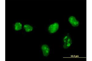 Immunofluorescence of monoclonal antibody to MKNK1 on HeLa cell. (MKNK1 Antikörper  (AA 1-465))