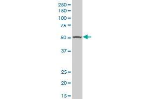 TGFBR1 polyclonal antibody (A01), Lot # ABNOVA060606QCS1 Western Blot analysis of TGFBR1 expression in HepG2 . (TGFBR1 Antikörper  (AA 30-125))