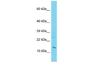 Host: Rabbit Target Name: C11orf1 Sample Type: Jurkat Whole Cell lysates Antibody Dilution: 1. (C11orf1 Antikörper  (C-Term))