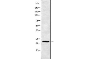 Western blot analysis of CIB4 using MCF7 whole cell lysates (CIB4 Antikörper  (C-Term))