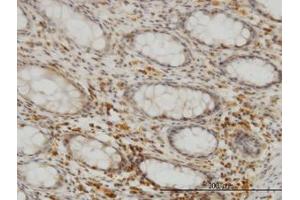 Image no. 3 for anti-Selenophosphate Synthetase 2 (SEPHS2) (AA 61-151) antibody (ABIN599185) (SEPHS2 Antikörper  (AA 61-151))