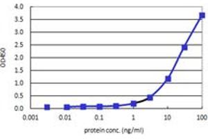 TK1 (Human) Matched Antibody Pair