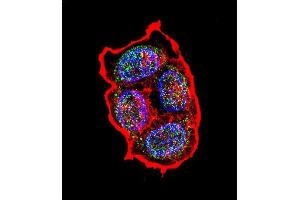 Confocal immunofluorescent analysis of AVP Antibody (Center) (ABIN651748 and ABIN2840385) with ZR-75-1 cell followed by Alexa Fluor 488-conjugated goat anti-rabbit lgG (green). (Vasopressin Antikörper  (AA 102-129))