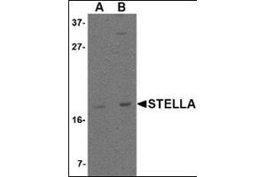 Western blot analysis of Stella in 293 cell lysate with this product at (A) 1 and (B) 2 μg/ml. (STELLAR/DPPA3 Antikörper  (C-Term))