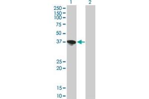Western Blotting (WB) image for anti-Sorbitol Dehydrogenase (SORD) (AA 1-111) antibody (ABIN599435) (SORD Antikörper  (AA 1-111))