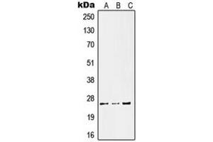 Western blot analysis of Kallikrein 11 expression in HeLa LPS-treated (A), SP2/0 UV-treated (B), PC12 LPS-treated (C) whole cell lysates. (Kallikrein 11 Antikörper  (Center))