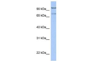 WB Suggested Anti-LCMT2 Antibody Titration:  0.