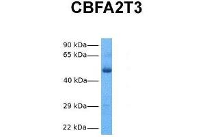 Host:  Rabbit  Target Name:  CBFA2T3  Sample Tissue:  Human Fetal Lung  Antibody Dilution:  1. (CBFA2T3 Antikörper  (N-Term))