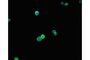 Immunofluorescent analysis of HepG2 cells using ABIN7145646 at dilution of 1:100 and Alexa Fluor 488-congugated AffiniPure Goat Anti-Rabbit IgG(H+L) (DBC1 Antikörper  (AA 20-320))