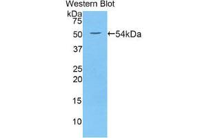 Western Blotting (WB) image for anti-Wingless-Type MMTV Integration Site Family, Member 10A (WNT10A) (AA 108-343) antibody (ABIN1860962) (WNT10A Antikörper  (AA 108-343))