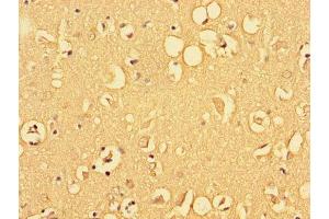 Immunohistochemistry of paraffin-embedded human brain tissue using ABIN7153215 at dilution of 1:100 (ALDOC Antikörper  (AA 190-354))