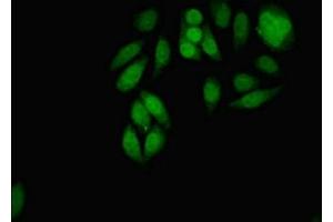 Immunofluorescent analysis of A549 cells using ABIN7159096 at dilution of 1:100 and Alexa Fluor 488-congugated AffiniPure Goat Anti-Rabbit IgG(H+L) (MDC1 Antikörper  (AA 1892-2082))