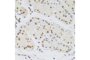 Immunohistochemistry of paraffin-embedded human stomach using HNRNPA1 Antibody (ABIN5975570) at dilution of 1/100 (40x lens). (HNRNPA1 Antikörper)