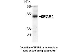Image no. 1 for anti-Early Growth Response 2 (EGR2) (AA 200-300) antibody (ABIN363607) (EGR2 Antikörper  (AA 200-300))