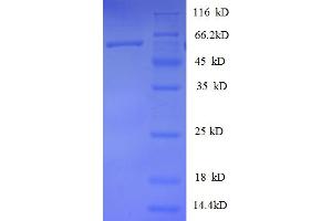 SDS-PAGE (SDS) image for Heterogeneous Nuclear Ribonucleoprotein D (HNRNPD) (AA 18-355), (partial) protein (GST tag) (ABIN5712241)