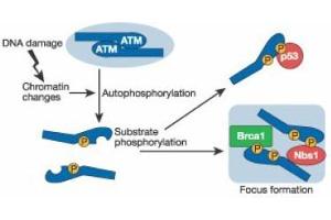 Image no. 2 for anti-Ataxia Telangiectasia Mutated (ATM) (pSer1981) antibody (ABIN401482) (ATM Antikörper  (pSer1981))