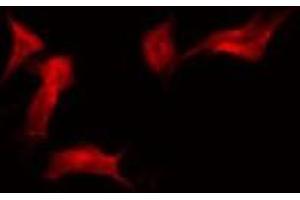 ABIN6275485 staining HuvEc by IF/ICC. (RFPL4A Antikörper  (Internal Region))