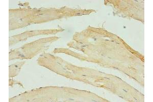 Immunohistochemistry of paraffin-embedded human skeletal muscle tissue using ABIN7171221 at dilution of 1:100 (STX1A Antikörper  (AA 2-228))