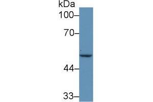 Western blot analysis of Human MCF7 cell lysate, using Mouse IRF6 Antibody (5 µg/ml) and HRP-conjugated Goat Anti-Rabbit antibody ( (IRF6 Antikörper  (AA 150-445))