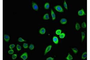Immunofluorescent analysis of A549 cells using ABIN7164562 at dilution of 1:100 and Alexa Fluor 488-congugated AffiniPure Goat Anti-Rabbit IgG(H+L) (ZDHHC1 Antikörper  (AA 283-389))