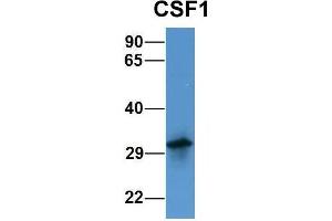 Western Blotting (WB) image for anti-Colony Stimulating Factor 1 (Macrophage) (CSF1) (Middle Region) antibody (ABIN2781824)
