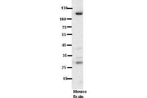 WB Suggested Anti-N6AMT1 Antibody Titration:  5% Milk  ELISA Titer:  dilution: 1:500  Positive Control:  Mouse Brain lysate (N6AMT1 Antikörper  (N-Term))