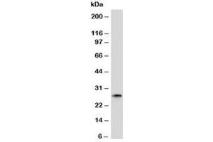 Western blot analysis of human spleen tissue and Kappa antibody. (Maus anti-Human Immunoglobulin kappa Chain Complex (Igk) Antikörper)
