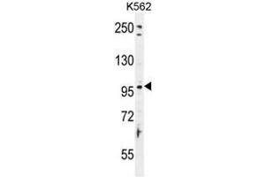 TAS1R2 Antibody (C-term) western blot analysis in K562 cell line lysates (35µg/lane). (TAS1R2 Antikörper  (C-Term))