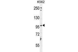 Western Blotting (WB) image for anti-Taste Receptor, Type 1, Member 2 (TAS1R2) (AA 698-726), (C-Term) antibody (ABIN955081)