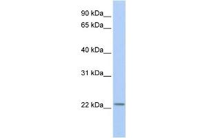 WB Suggested Anti-HIST1H1T Antibody Titration: 0. (Histone Cluster 1, H1t (HIST1H1T) (Middle Region) Antikörper)