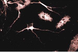 Immunofluorescence (IF) image for anti-Adaptor-Related Protein Complex 1, gamma 1 Subunit (AP1G1) (AA 642-821) antibody (ABIN967934)