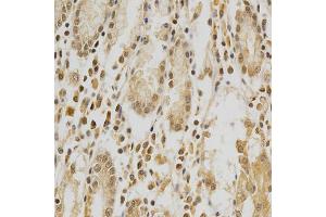 Immunohistochemistry of paraffin-embedded human stomach using HDAC6 antibody (ABIN5997884) at dilution of 1/100 (40x lens). (HDAC6 Antikörper)