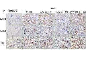 MiR-30c reduced fibrosis in DN via reducing TGF-β1 secretion from TECs. (COL4A1 Antikörper  (AA 1445-1669))
