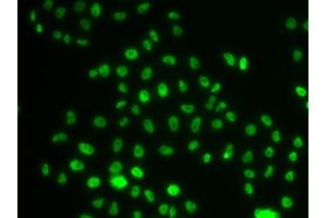 Immunofluorescence analysis of MCF-7 cells using PHIP antibody (ABIN6129078, ABIN6145556, ABIN6145557 and ABIN6223036). (PHIP Antikörper  (AA 1542-1821))
