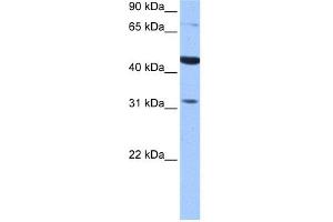 WB Suggested Anti-TPRXL Antibody Titration:  0. (TPRXL Antikörper  (C-Term))