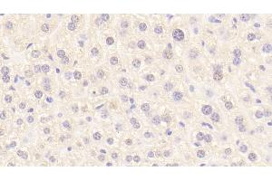 Detection of PROC in Mouse Liver Tissue using Polyclonal Antibody to Protein C (PROC) (PROC Antikörper  (AA 197-436))