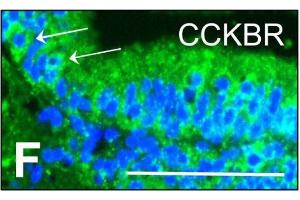 Homogenous, granular expression of CCKBR is seen within the neuroepithelial cells, with intense perinuclear labelling. (CCKBR Antikörper  (AA 301-400))