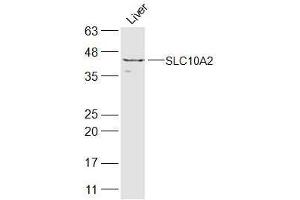 Mouse liver lysate probed with SLC10A2 Polyclonal Antibody  at 1:300 overnight at 4˚C.