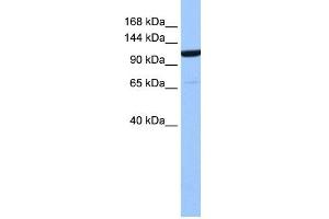 WB Suggested Anti-NUP155 Antibody Titration: 0. (NUP155 Antikörper  (Middle Region))