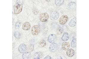 Immunohistochemistry (IHC) image for anti-Histone Deacetylase 7 (HDAC7) (AA 902-952) antibody (ABIN7448594) (HDAC7 Antikörper  (AA 902-952))