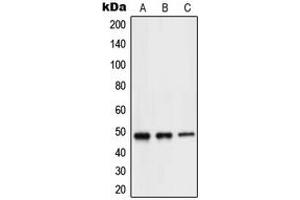 Western blot analysis of NEUROD2 expression in Jurkat (A), mouse brain (B), rat brain (C) whole cell lysates.