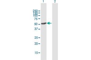 Western Blot analysis of IFI44 expression in transfected 293T cell line by IFI44 MaxPab polyclonal antibody.